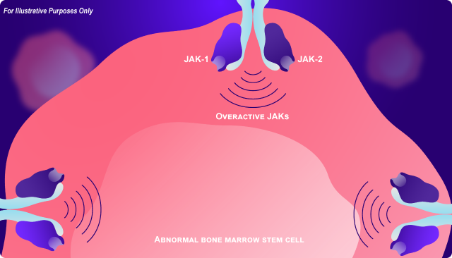 Abnormal bone marrow stem cell